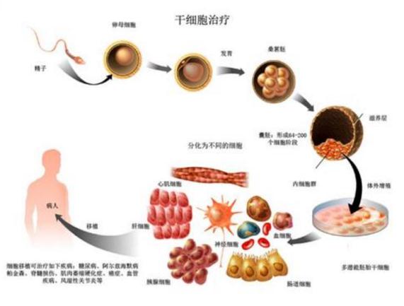 How far is stem cell therapy from us?