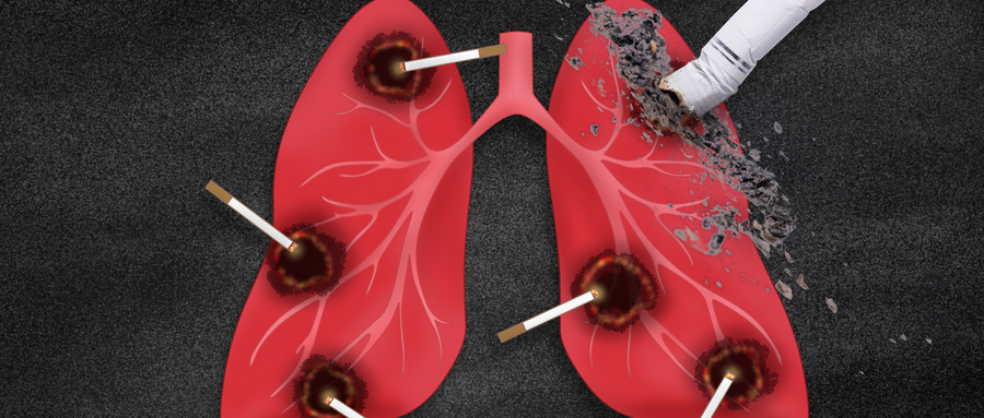 Is cancer screening necessary? When will it be done?