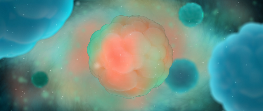 MSM氨糖软骨素：关节健康的“润滑剂”与“修复师”